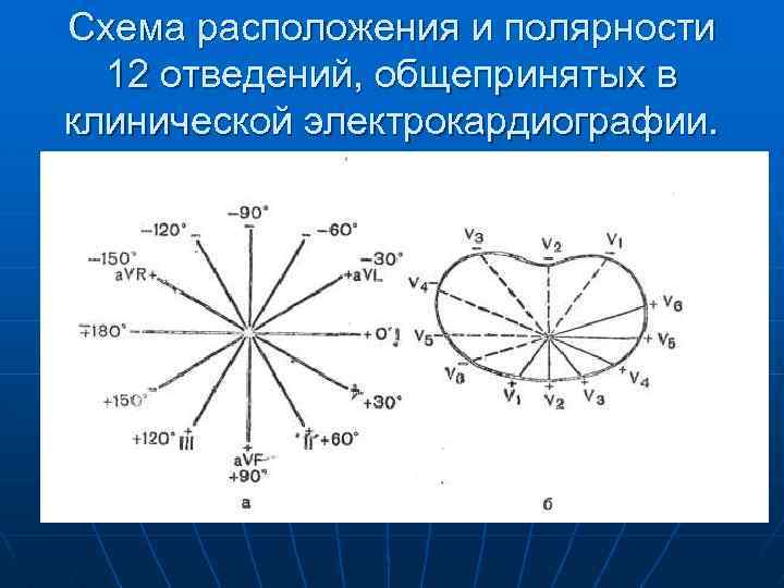 Схема расположения и полярности 12 отведений, общепринятых в клинической электрокардиографии. 