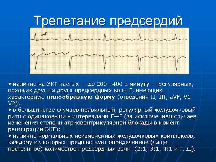 Трепетание предсердий • наличие на ЭКГ частых — до 200— 400 в минуту —