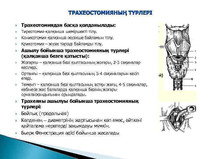  Трахеотомиядан басқа қолданылады: Тиреотомия-қалқанша шеміршекті тілу. Коникотомия-қалқанша-жүзікше байламын тілу. Крикотомия – жүзік тәрізді