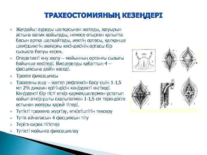  Жағдайы: аурады шалқасынан жатады, жауырын астына валик қойылады, немесе отырған қалыпта басын артқа