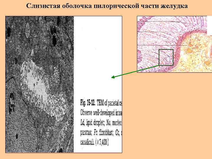 Слизистая оболочка пилорической части желудка 