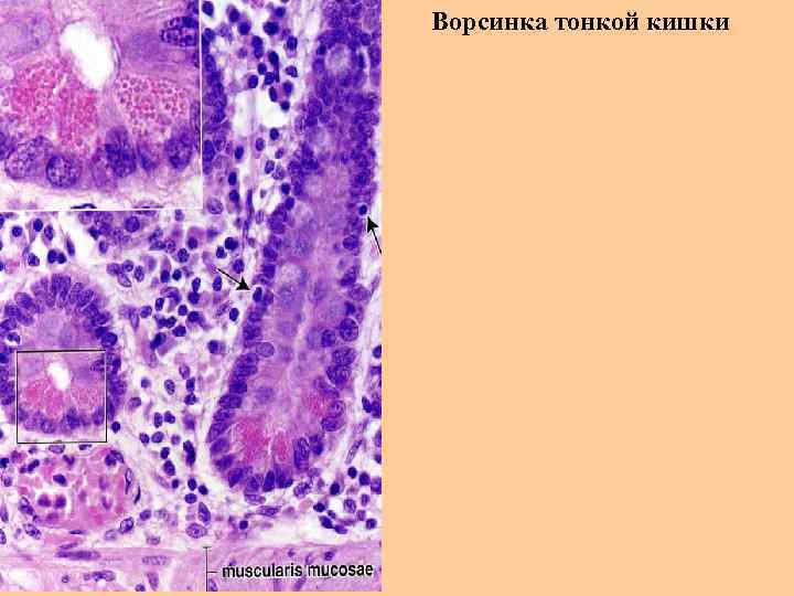 Ворсинка тонкой кишки 