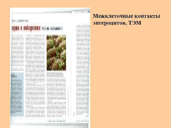 Межклеточные контакты энтероцитов, ТЭМ 