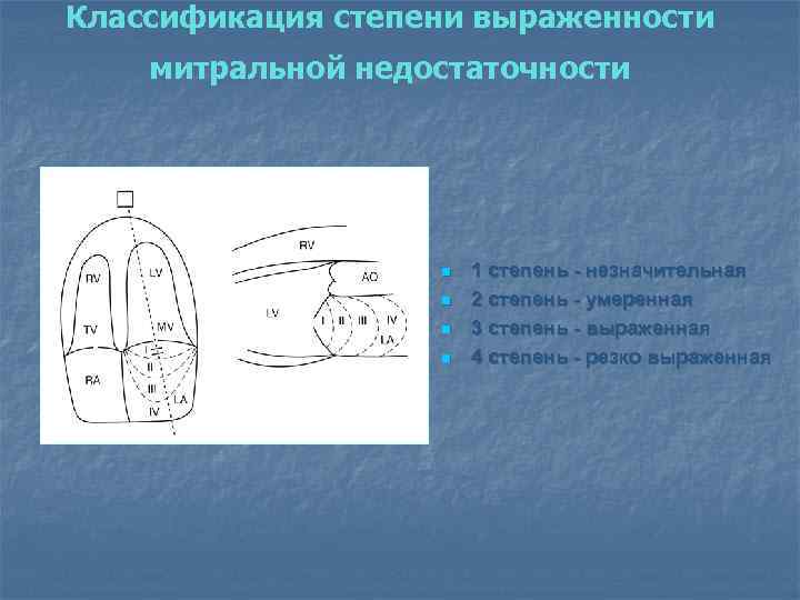 Классификация степени выраженности митральной недостаточности n n 1 степень - незначительная 2 степень -