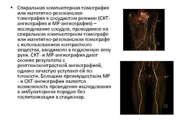  • Спиральная компьютерная томография или магнтитно-резонансная томография в сосудистом режиме (СКТангиография и МР-ангиография)