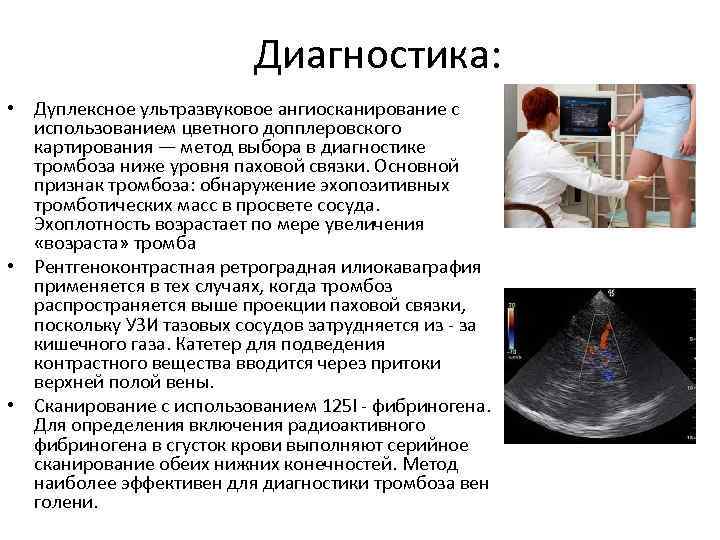 Диагностика: • Дуплексное ультразвуковое ангиосканирование с использованием цветного допплеровского картирования — метод выбора в