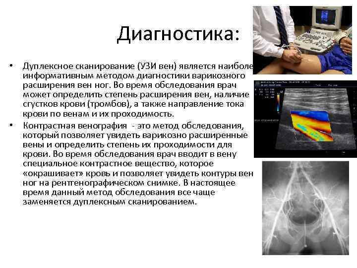 Диагностика: • Дуплексное сканирование (УЗИ вен) является наиболее информативным методом диагностики варикозного расширения вен