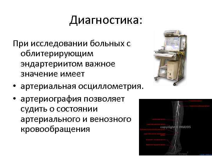 Диагностика: При исследовании больных с облитерирующим эндартериитом важное значение имеет • артериальная осциллометрия. •