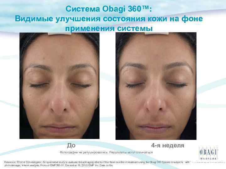 Система Obagi 360™: Видимые улучшения состояния кожи на фоне применения системы До 4 -я