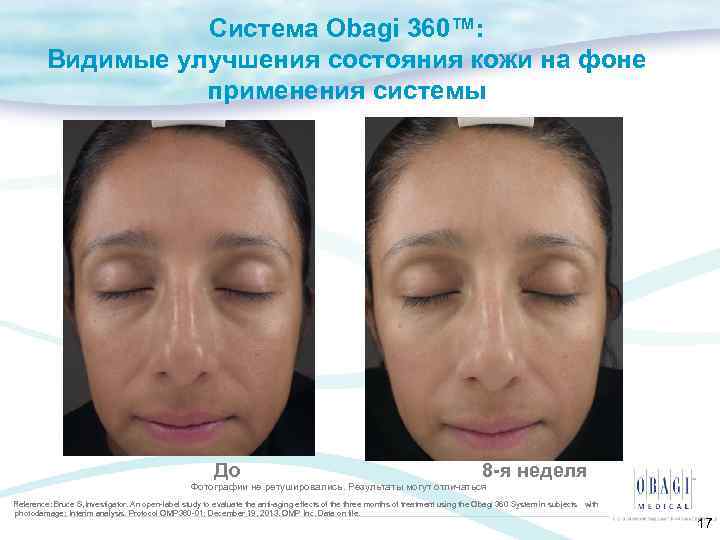 Система Obagi 360™: Видимые улучшения состояния кожи на фоне применения системы До 8 -я
