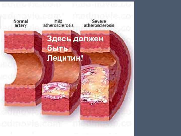 Здесь должен быть Лецитин! 