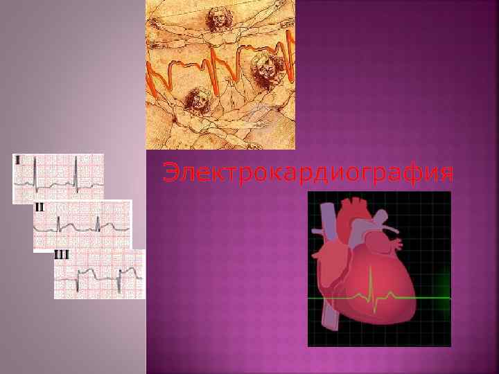 Электрокардиография 