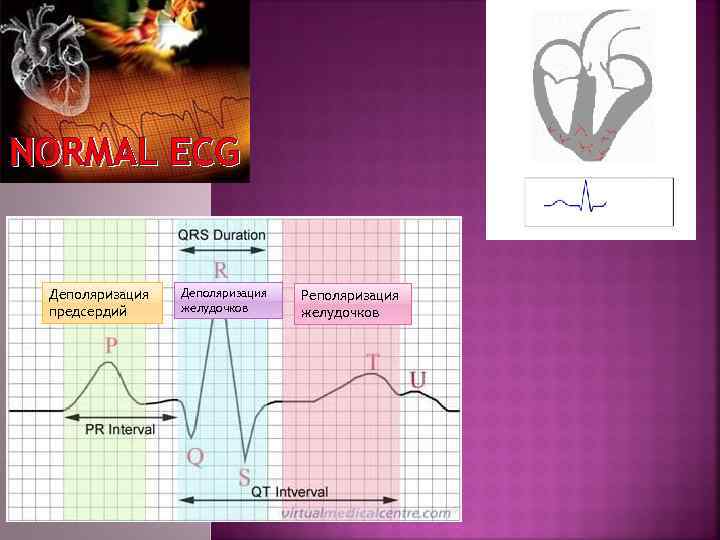 NORMAL ECG Деполяризация предсердий Деполяризация желудочков Реполяризация желудочков 