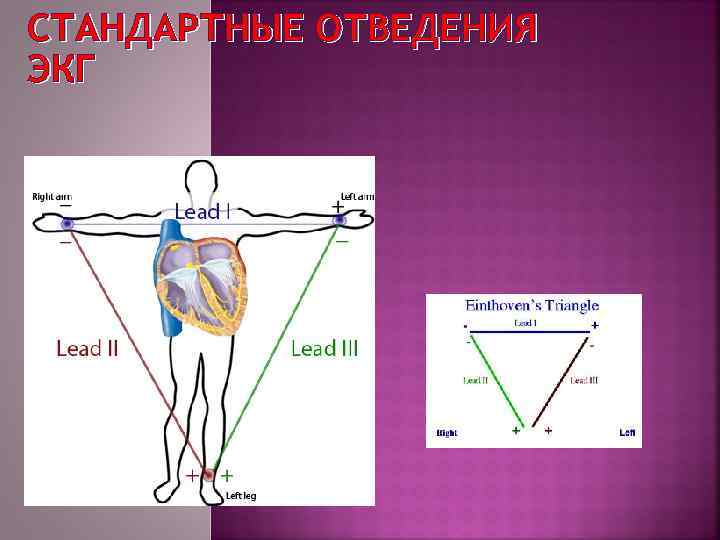 СТАНДАРТНЫЕ ОТВЕДЕНИЯ ЭКГ 