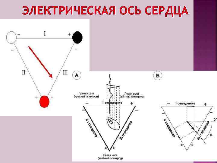 ЭЛЕКТРИЧЕСКАЯ ОСЬ СЕРДЦА 