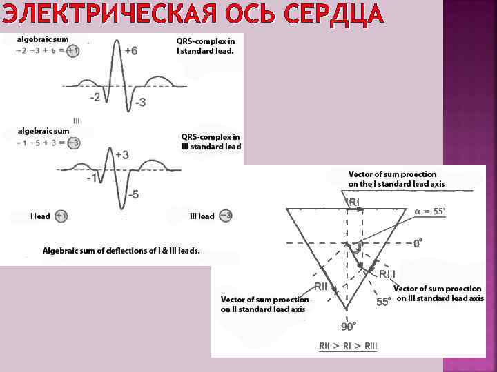 ЭЛЕКТРИЧЕСКАЯ ОСЬ СЕРДЦА 