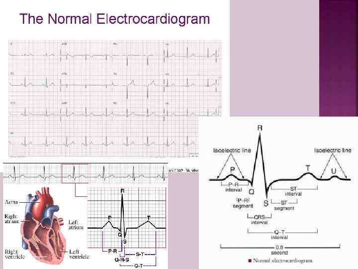 NORMAL ECG 