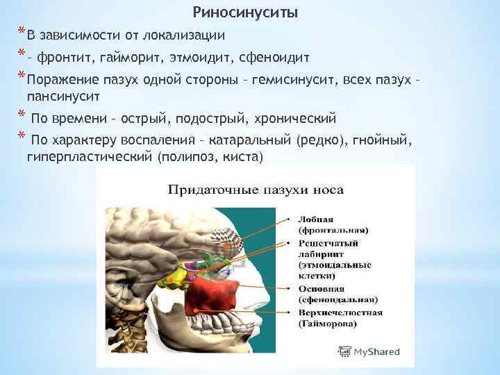 Риносинуситы * В зависимости от локализации * – фронтит, гайморит, этмоидит, сфеноидит * Поражение