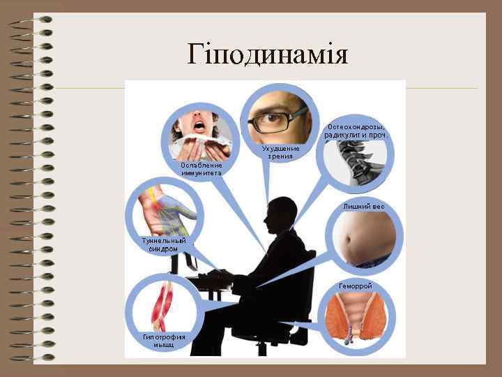 Гіподинамія 