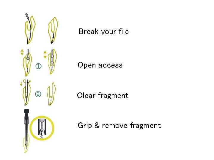 Break your file Open access Clear fragment Grip & remove fragment 