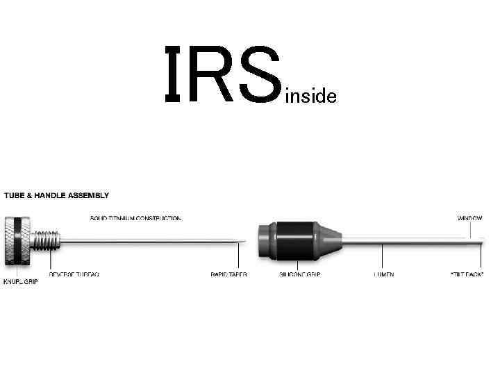 IRS inside 