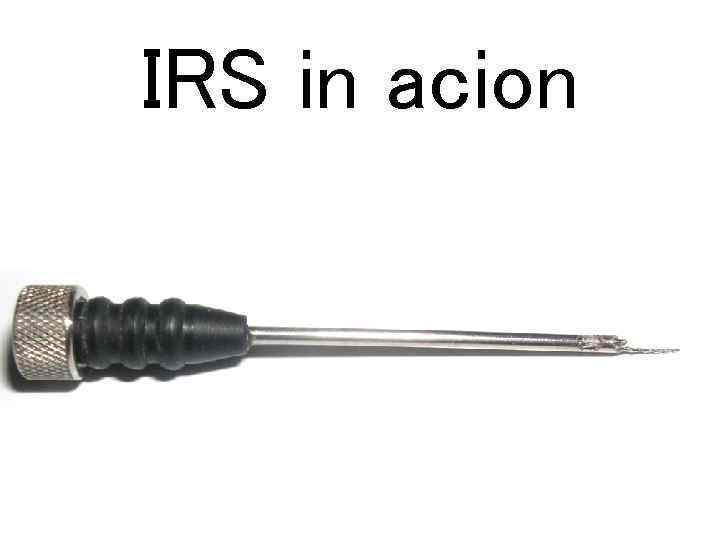 IRS in acion 