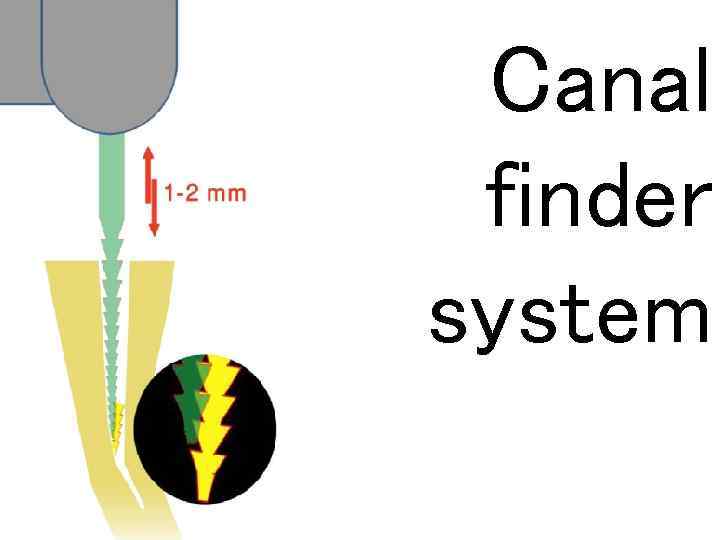 Canal finder system 