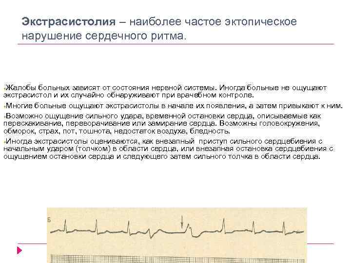 Экстрасистолия – наиболее частое эктопическое нарушение сердечного ритма. Жалобы больных зависят от состояния нервной