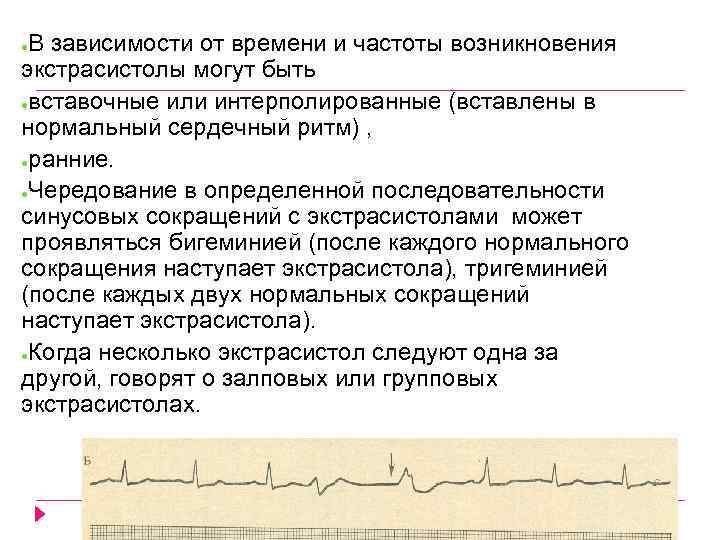 В зависимости от времени и частоты возникновения экстрасистолы могут быть ●вставочные или интерполированные (вставлены