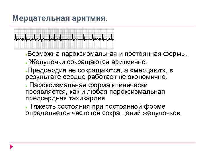 Мерцательная аритмия. Возможна пароксизмальная и постоянная формы. ● Желудочки сокращаются аритмично. ●Предсердия не сокращаются,