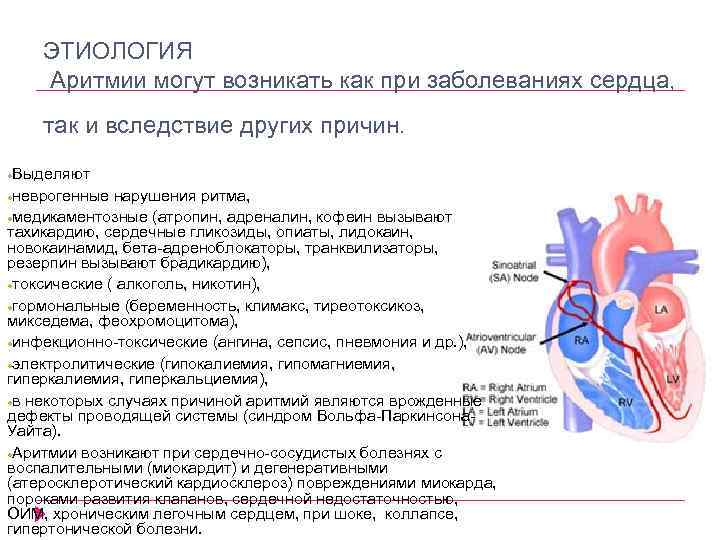 ЭТИОЛОГИЯ Аритмии могут возникать как при заболеваниях сердца, так и вследствие других причин. Выделяют