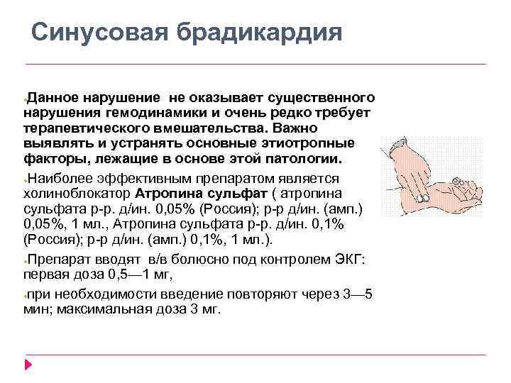 Синусовая брадикардия Данное нарушение не оказывает существенного нарушения гемодинамики и очень редко требует терапевтического