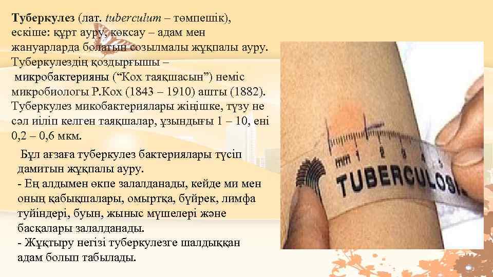 Туберкулез (лат. tuberculum – төмпешік), ескіше: құрт ауру, көксау – адам мен жануарларда болатын