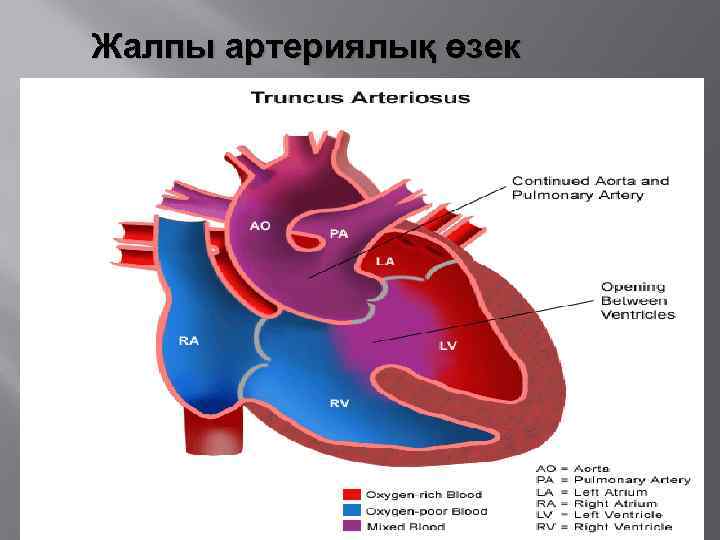 Жалпы артериялық өзек 