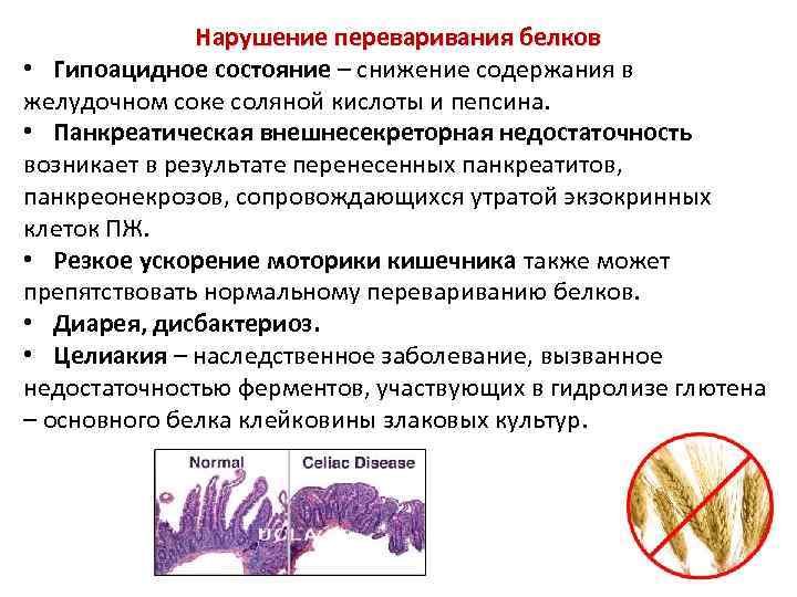 Нарушение переваривания белков • Гипоацидное состояние – снижение содержания в желудочном соке соляной кислоты