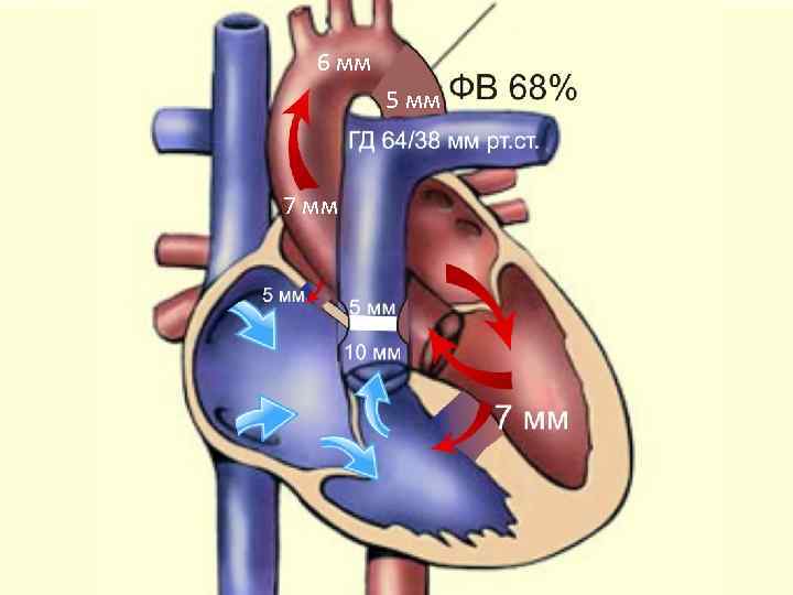6 мм 5 мм 7 мм 