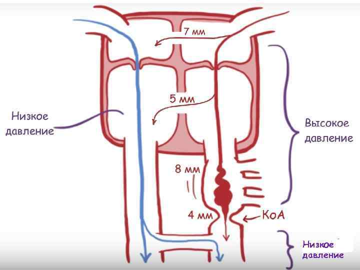 Низкое давление 