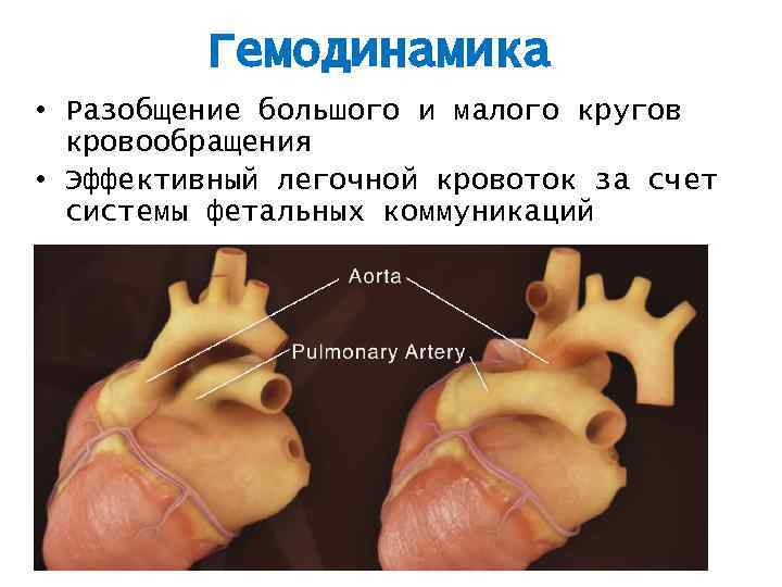 Гемодинамика • Разобщение большого и малого кругов кровообращения • Эффективный легочной кровоток за счет
