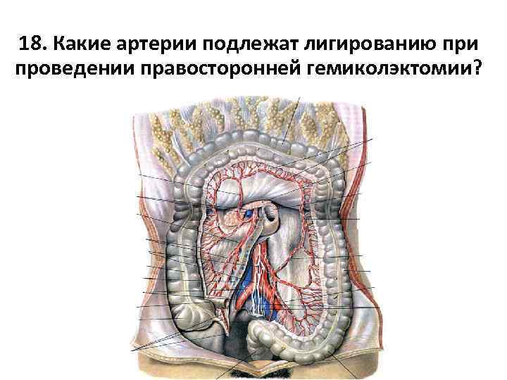 18. Какие артерии подлежат лигированию при проведении правосторонней гемиколэктомии? 