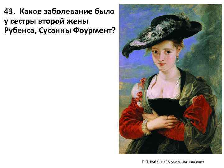 43. Какое заболевание было у сестры второй жены Рубенса, Сусанны Фоурмент? П. П. Рубенс