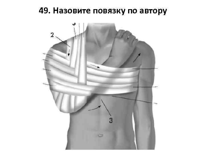 49. Назовите повязку по автору 