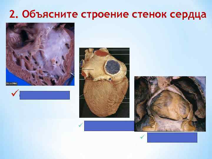 2. Объясните строение стенок сердца üendocardium ü myocardium ü epicardium 