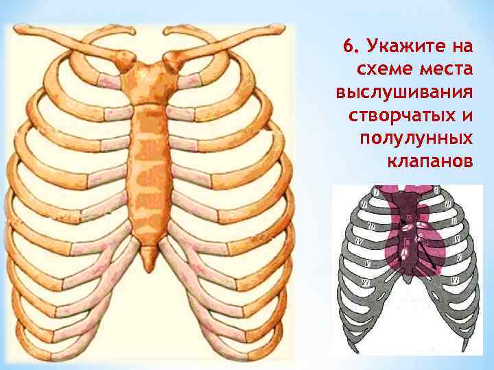 6. Укажите на схеме места выслушивания створчатых и полулунных клапанов 