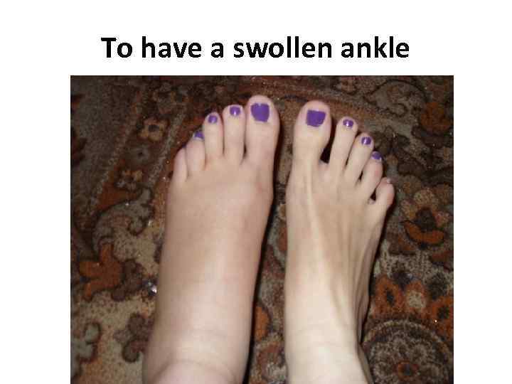 To have a swollen ankle 