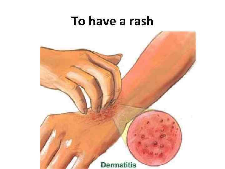 To have a rash 