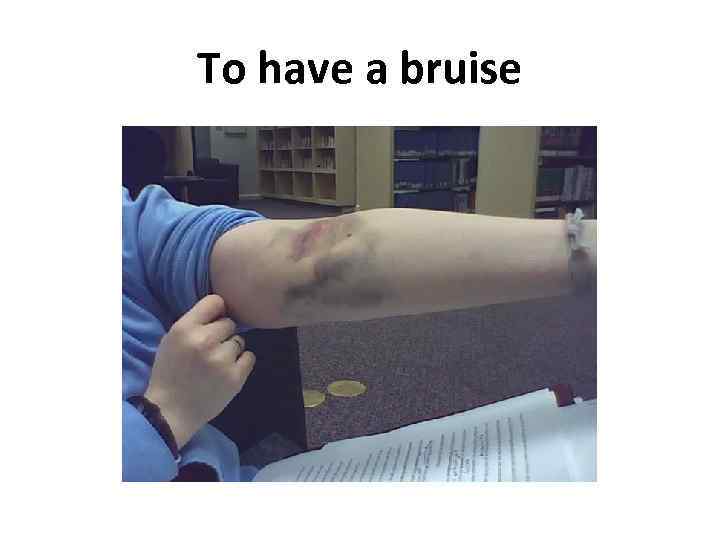 To have a bruise 