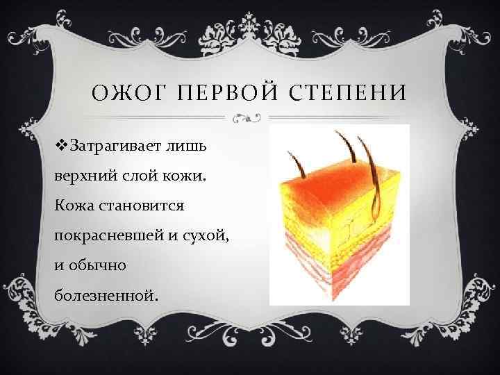 ОЖОГ ПЕРВОЙ СТЕПЕНИ v. Затрагивает лишь верхний слой кожи. Кожа становится покрасневшей и сухой,