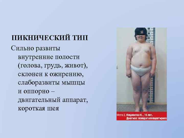 ПИКНИЧЕСКИЙ ТИП Сильно развиты внутренние полости (голова, грудь, живот), склонен к ожирению, слаборазвиты мышцы