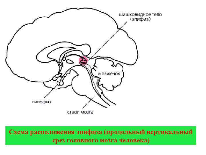 Схема расположения эпифиза (продольный вертикальный срез головного мозга человека) 