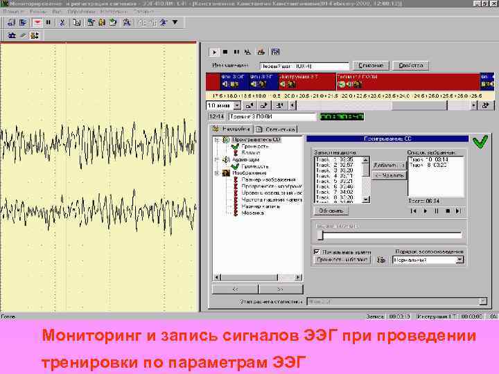 Мониторинг и запись сигналов ЭЭГ при проведении тренировки по параметрам ЭЭГ 